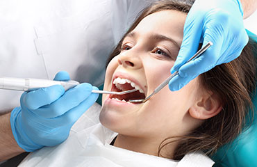 Cleaning and Prevention for Tyson Family Dental offering dental services for the entire Fort Worth Metro Area out of our dentist office in Benbrook Texas
